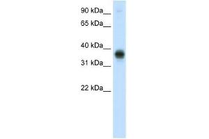 E2F3 antibody used at 0. (E2F3 抗体  (C-Term))