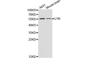 Western blot analysis of extracts of various cell lines, using LYN antibody. (LYN 抗体  (AA 1-240))