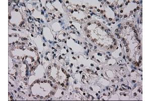 Immunohistochemical staining of paraffin-embedded Kidney tissue using anti-NRBP1mouse monoclonal antibody. (NRBP1 抗体)