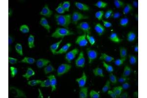 Immunofluorescence staining of A549 cells with ABIN7173187 at 1:100, counter-stained with DAPI. (TMEM26 抗体  (AA 302-368))