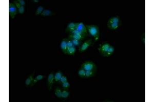 Immunofluorescence staining of HepG2 cells with ABIN7154328 at 1:100, counter-stained with DAPI. (Golgin B1 (GOLGB1) (AA 1764-1869) 抗体)