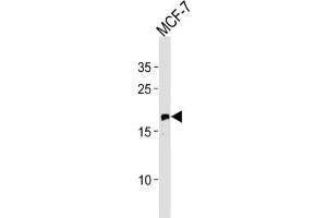 Western Blotting (WB) image for anti-GTPase NRas (NRAS) antibody (ABIN3003468) (GTPase NRas 抗体)
