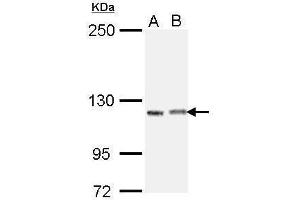 WB Image Sample (30 ug of whole cell lysate) A: H1299 B: Raji 5% SDS PAGE antibody diluted at 1:1000 (IGSF3 抗体)