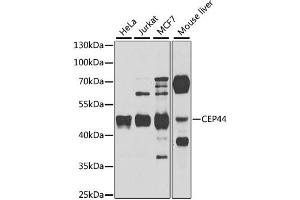 Western blot analysis of extracts of various cell lines, using CEP44 antibody. (CEP44 抗体)