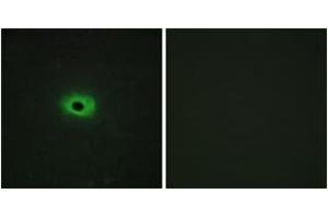 Immunofluorescence analysis of HeLa cells, using TNF12 Antibody. (TWEAK 抗体  (AA 41-90))
