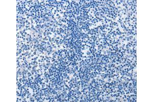 Immunohistochemistry (IHC) image for anti-MutS Homolog 6 (E. Coli) (MSH6) antibody (ABIN1873754) (MSH6 抗体)