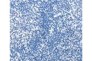 Immunohistochemistry (IHC) image for anti-MutS Homolog 6 (E. Coli) (MSH6) antibody (ABIN1873754) (MSH6 抗体)