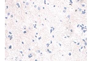 Detection of CK2 in Human Cerebrum Tissue using Polyclonal Antibody to Keratin 2 (CK2) (Keratin 2 抗体  (AA 7-160))