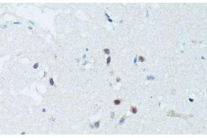 Immunohistochemistry of paraffin-embedded Human brain using MEF2C Polyclonal Antibody at dilution of 1:100 (40x lens). (MEF2C 抗体)
