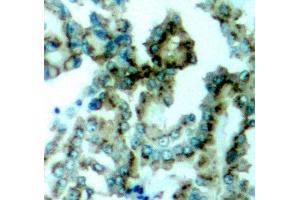 Immunohistochemistry (IHC) image for anti-Protein Kinase C, beta (PRKCB) (pThr641) antibody (ABIN1870521) (PKC beta 抗体  (pThr641))