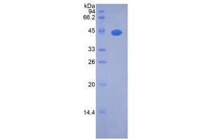 SDS-PAGE analysis of Rat Noggin Protein. (NOG 蛋白)