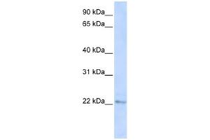 WB Suggested Anti-C6orf64 Antibody Titration:  0. (SAYSD1 抗体  (C-Term))