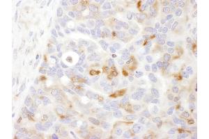 Immunohistochemistry (IHC) image for anti-Bridging Integrator 1 (BIN1) (AA 543-593) antibody (ABIN7454858)