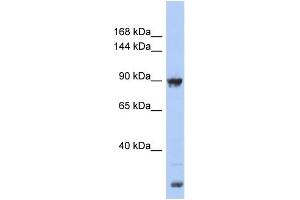 WB Suggested Anti-URG4 Antibody Titration: 0.