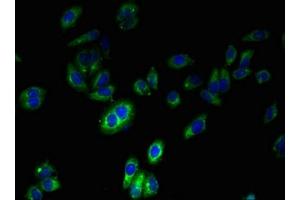 Immunofluorescent analysis of HepG2 cells using ABIN7160754 at dilution of 1:100 and Alexa Fluor 488-congugated AffiniPure Goat Anti-Rabbit IgG(H+L) (FPR2 抗体  (AA 307-351))