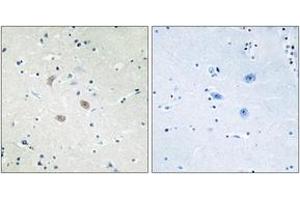 Immunohistochemistry (IHC) image for anti-V-Akt Murine Thymoma Viral Oncogene Homolog 2 (AKT2) (AA 432-481) antibody (ABIN2888944) (AKT2 抗体  (AA 432-481))