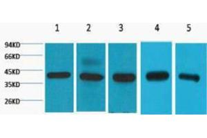 Western Blotting (WB) image for anti-Eukaryotic Translation Initiation Factor 4A1 (EIF4A1) antibody (ABIN3178689) (EIF4A1 抗体)