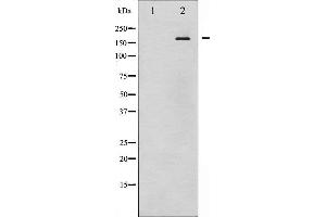 Western blot analysis of EGFR phosphorylation expression in EGF treated HuvEc whole cell lysates,The lane on the left is treated with the antigen-specific peptide. (EGFR 抗体  (pTyr1097))