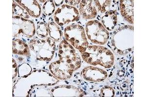 Immunohistochemistry (IHC) image for anti-Bruton Agammaglobulinemia tyrosine Kinase (BTK) antibody (ABIN1496972) (BTK 抗体)