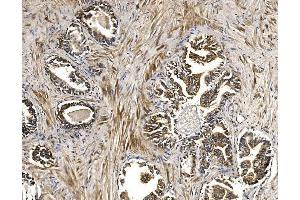 IHC analysis of BCKDHA using anti-BCKDHA antibody (ABIN7601223).
