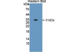 Detection of Recombinant CARD9, Human using Polyclonal Antibody to Caspase Recruitment Domain Family, Member 9 (CARD9) (CARD9 抗体  (AA 26-283))