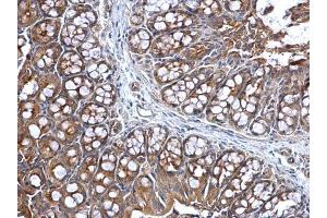 Immunohistochemistry (IHC) image for anti-Lysyl-tRNA Synthetase (KARS) antibody (ABIN2855293)