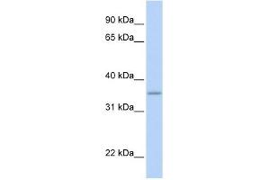 GRHPR antibody used at 1 ug/ml to detect target protein. (GRHPR 抗体  (N-Term))
