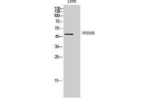 Western Blotting (WB) image for anti-Vacuolar Protein Sorting 26 Homolog B (VPS26B) (Internal Region) antibody (ABIN3187482) (VPS26B 抗体  (Internal Region))