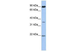 C13ORF7 antibody used at 1 ug/ml to detect target protein. (RNF219 抗体  (N-Term))