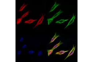 ABIN6259797 and ABIN6277038 staining Hela cells by IF/ICC. (ADH5 抗体  (C-Term))
