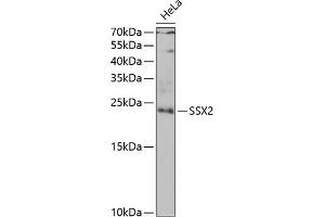 Western blot analysis of extracts of HeLa cells, using SSX2 antibody (ABIN6128794, ABIN6148505, ABIN6148507 and ABIN6222753) at 1:1000 dilution. (SSX2 抗体  (AA 1-188))