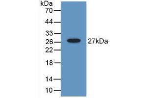 Detection of Recombinant Gelsolin, Mouse using Polyclonal Antibody to Gelsolin (GSN) (Gelsolin 抗体  (AA 432-625))