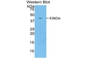 Western blot analysis of the recombinant protein. (IL12RB2 抗体  (AA 559-647))