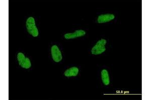 Immunofluorescence (IF) image for anti-General Transcription Factor IIH, Polypeptide 2, 44kDa (GTF2H2) (AA 1-395) antibody (ABIN516267)