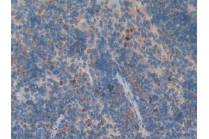DAB staining on IHC-P; Samples: Rat Spleen Tissue (GDF3 抗体  (AA 253-366))