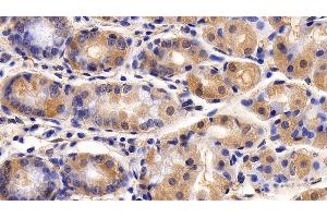 Immunohistochemistry (IHC) image for anti-Calponin 1 (CNN1) (AA 1-268) antibody (ABIN7436681)
