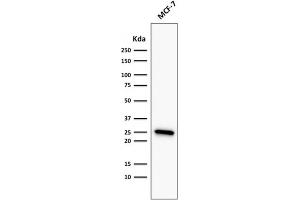 ABIN6383839 to BCL2 was successfully used to stain an approx. (Recombinant Bcl-2 抗体)