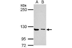 WB Image Sample (30 ug of whole cell lysate) A: Jurkat B: K562 5% SDS PAGE antibody diluted at 1:1000 (UNC13D 抗体  (C-Term))