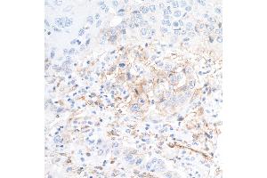 Immunohistochemistry (IHC) image for anti-5'-Nucleotidase, Ecto (CD73) (NT5E) (AA 27-552) antibody (ABIN7449540) (Recombinant CD73 抗体  (AA 27-552))