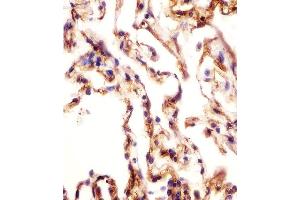 (ABIN652478 and ABIN2842325) staining AOC3 in human lung tissue sections by Immunohistochemistry (IHC-P - paraformaldehyde-fixed, paraffin-embedded sections). (AOC3 抗体  (AA 613-640))
