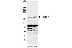 Western Blotting (WB) image for anti-Topoisomerase (DNA) II Binding Protein 1 (TOPBP1) (C-Term) antibody (ABIN7452107)