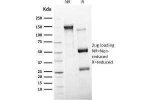 SDS-PAGE Analysis Purified CD11c Mouse Monoclonal Antibody (ITGAX/2507). (CD11c 抗体  (AA 637-827))