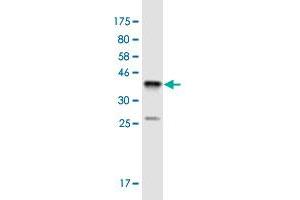 Western Blot detection against Immunogen (36. (SSX4 抗体  (AA 91-188))