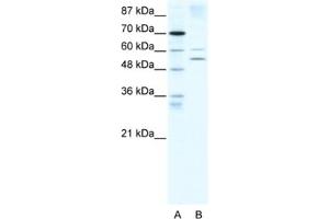 Western Blotting (WB) image for anti-Autoimmune Regulator (AIRE) antibody (ABIN2460527) (AIRE 抗体)