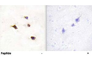Immunohistochemistry analysis of paraffin-embedded human brain tissue using IP6K3 polyclonal antibody . (IP6K3 抗体)