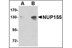 Western blot analysis of NUP155 in P815 cell lysate with this product at (A) 0. (NUP155 抗体  (C-Term))