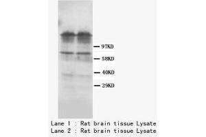 Image no. 1 for anti-Dopamine Receptor D1 (DRD1) (C-Term) antibody (ABIN1493058) (Dopamine Receptor d1 抗体  (C-Term))