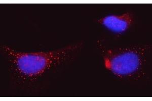 IF analysis of BI-1/TMBIM6 using anti-BI-1/TMBIM6 antibody (ABIN7603199). (Bax Inhibitor 1 抗体  (N-Term))