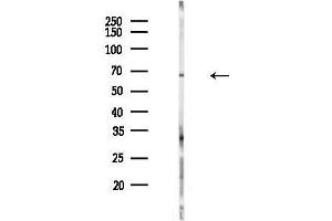 Western blot analysis of lysates from  cells(heat-shock,45 min treatment), using WAVE4 Antibody at 1/1000 dilution. (WAVE4 抗体  (C-Term))