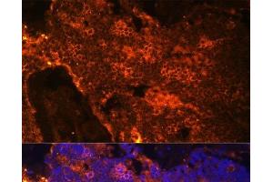 Immunofluorescence (IF) image for anti-Spectrin alpha 1, Erythrocytic (SPTA1) antibody (ABIN7256054)